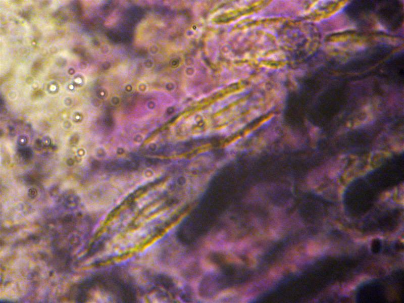 Crosta da determinare (Peniophora incarnata)